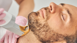 Définition de la barbe au laser